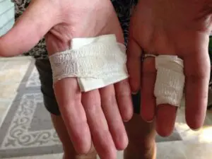Bandages with Aloe Vera under them
