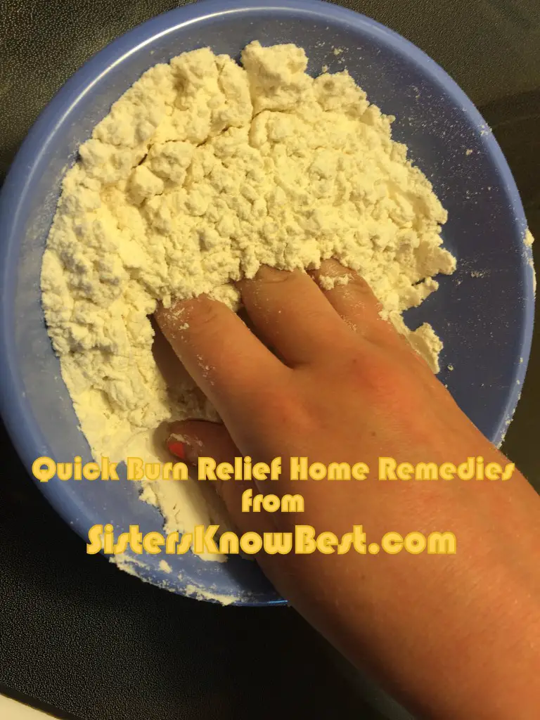 Home remedies for oil burn