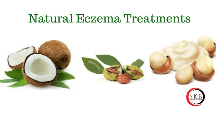 Natural Eczema Treatments by Sisters Know Best